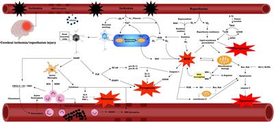 miRNA Involvement in Cerebral Ischemia-Reperfusion Injury